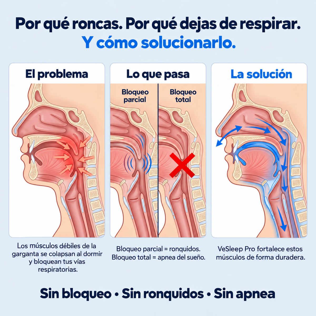 VeSleep: Elimina ronquidos y Apnea del sueño